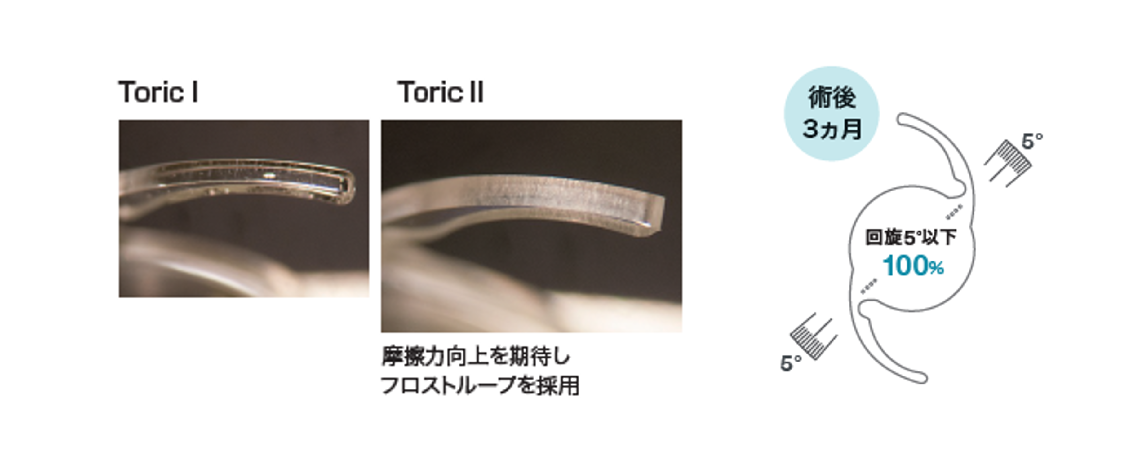 乱視矯正モデルにはToricⅡデザインを採用