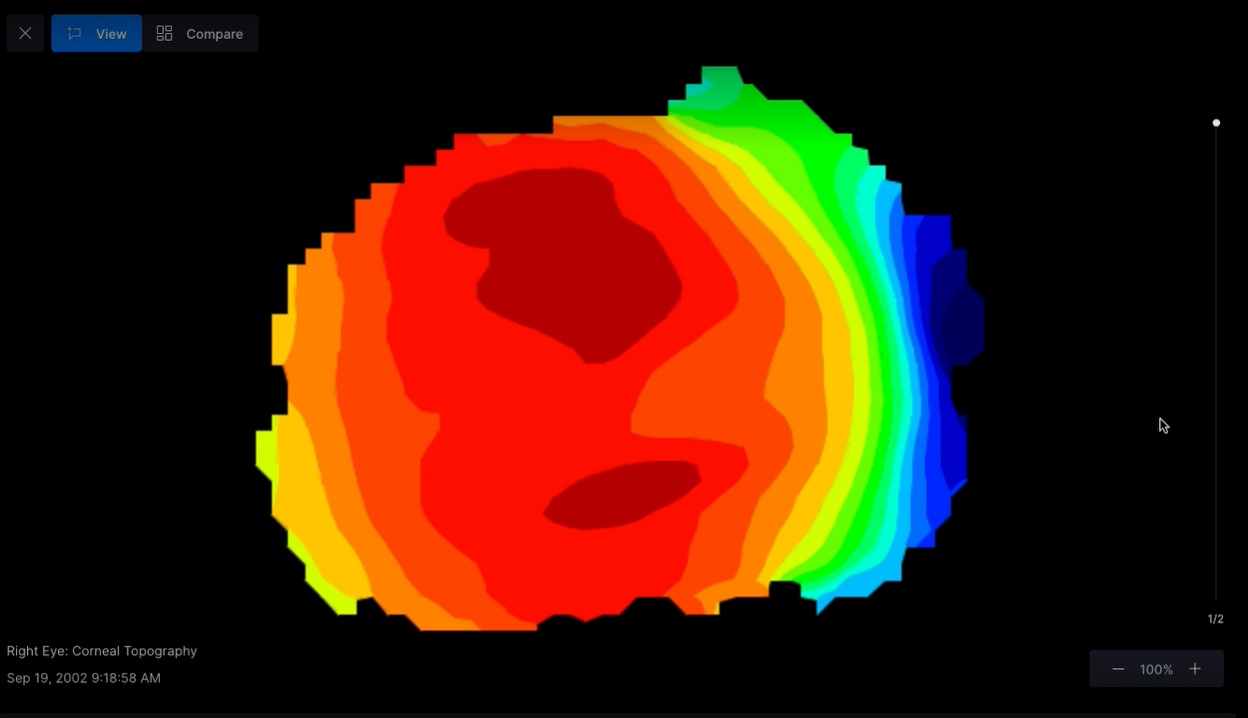 FitAbiliti™, topography-based