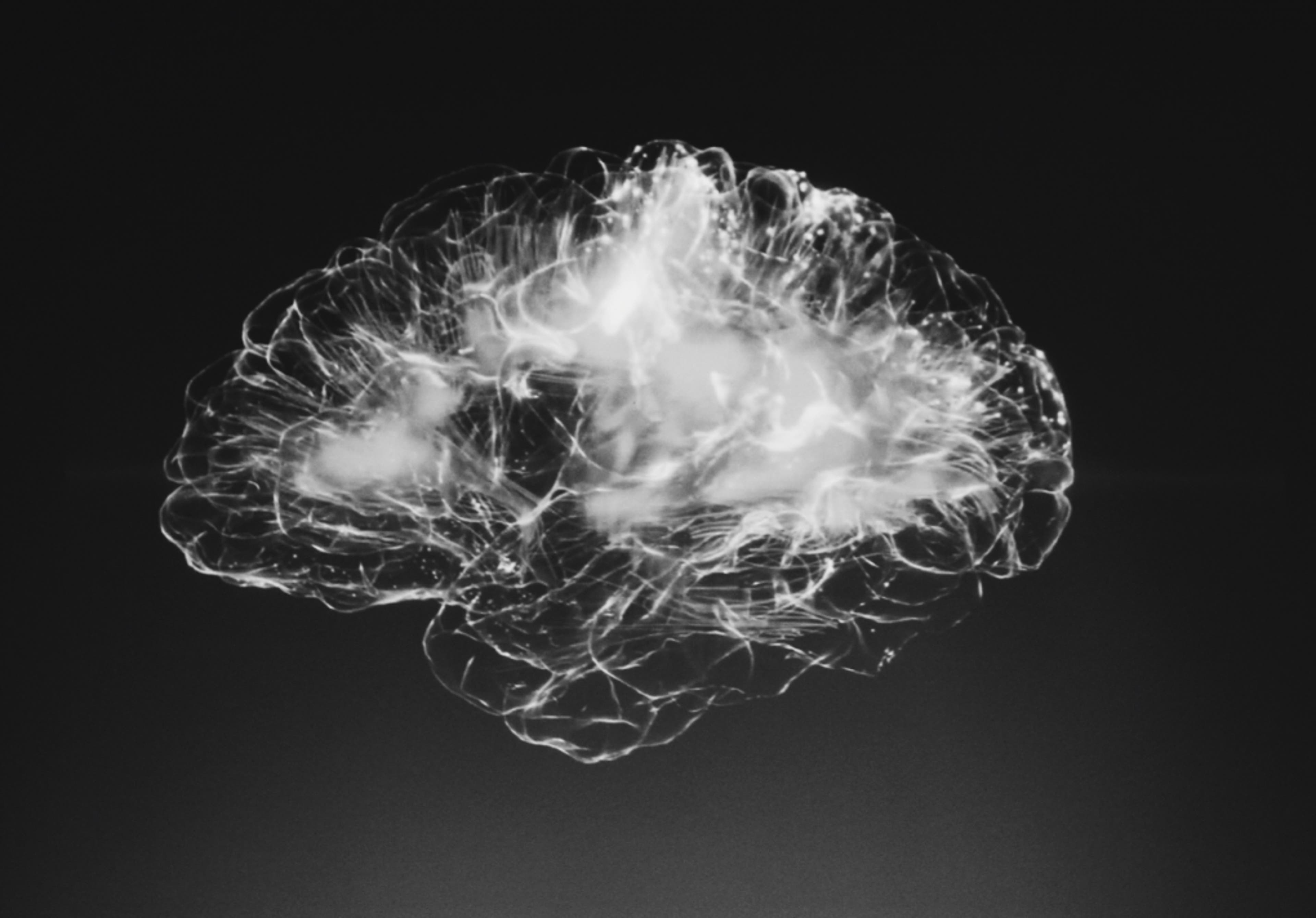 brain-scan-blackandwhite-healthcare.png