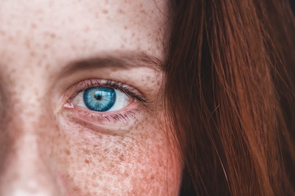 blue-eye-freckles-biometrics.jpg