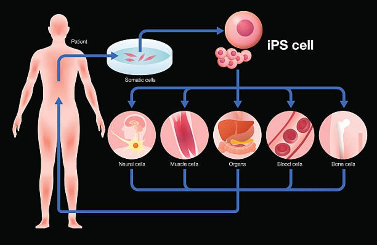 Overcoming Barriers of CRISPR Gene Editing in iPS Cells