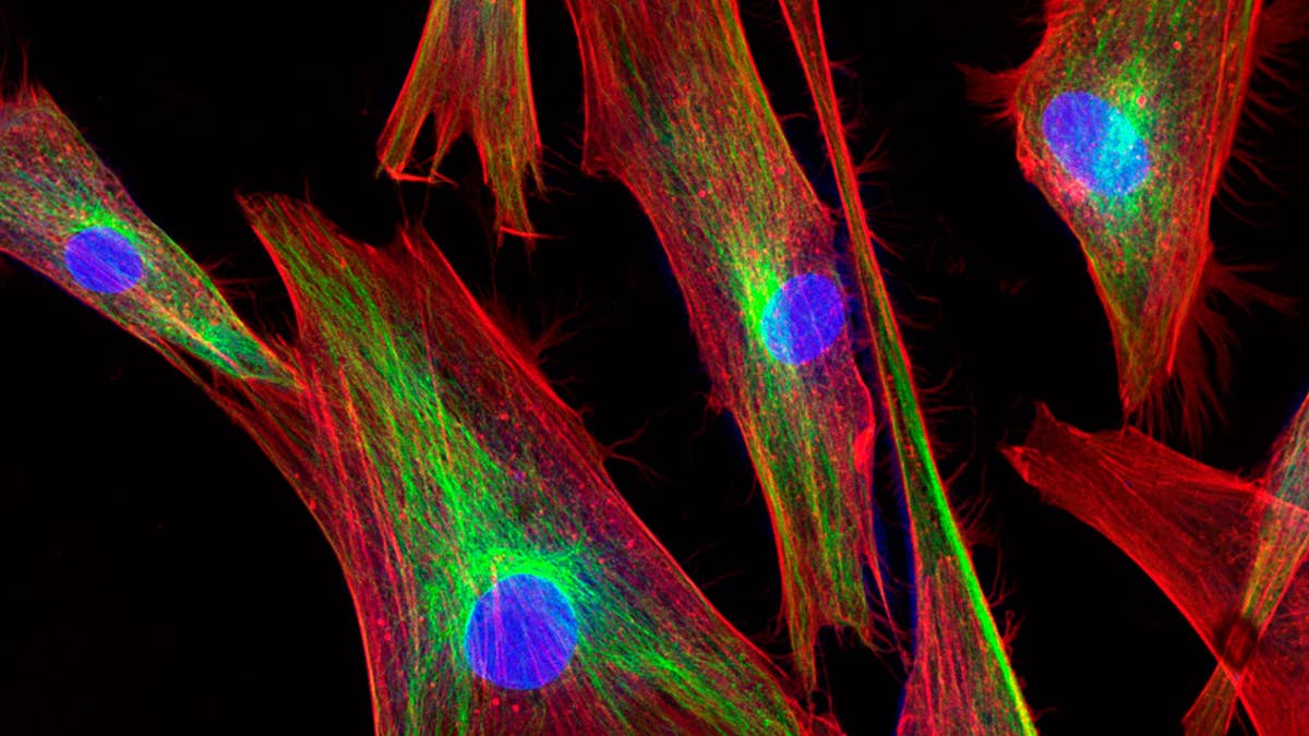 confocal-microscopy-of-fibroblast-cells.jpg