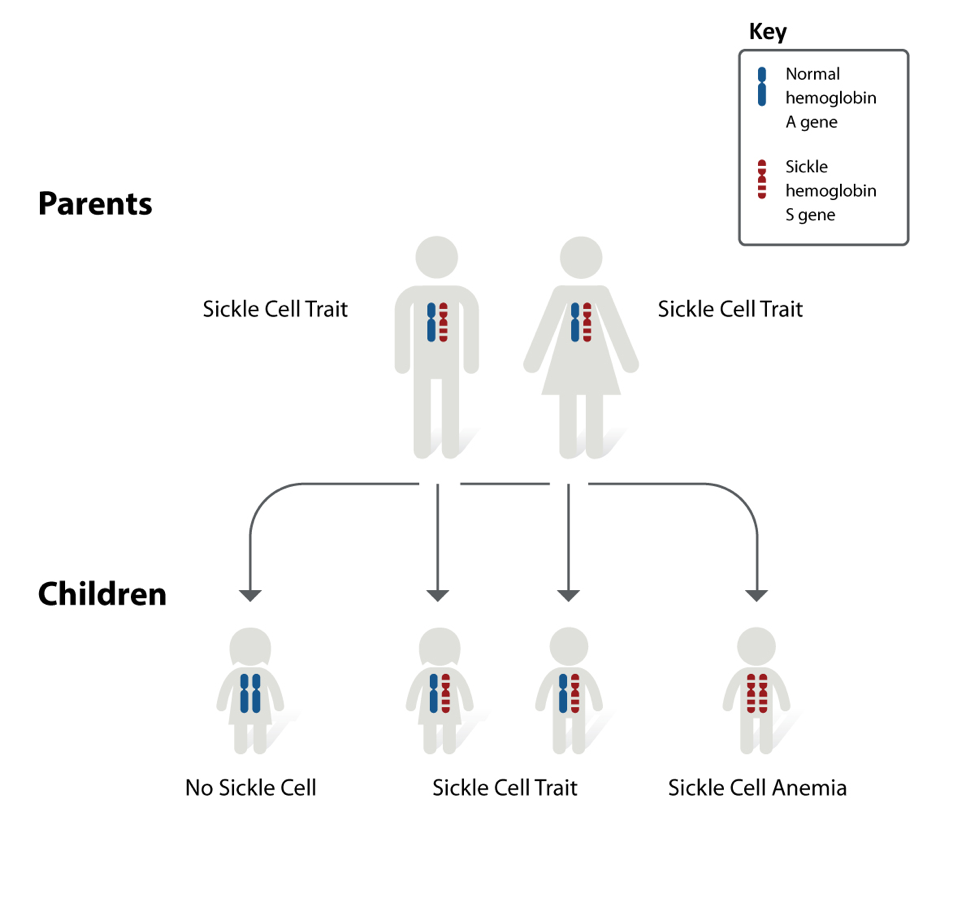 CRISPR Sickle Cell Gene Therapy: Approaches, Challenges, And Progress