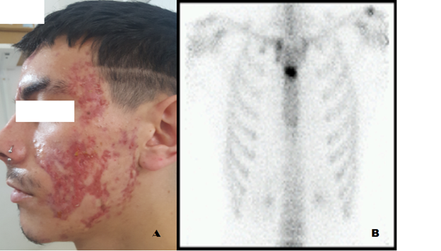 Latin America & Caribbean Regional Winner