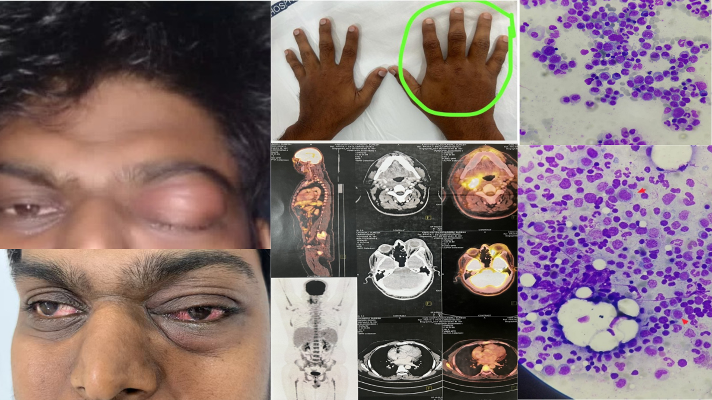 South Asia Regional Winner and People’s Choice Winner