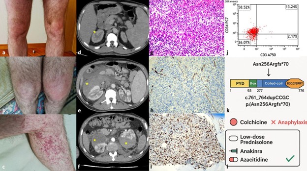 Europe & Central Asia Regional Winner