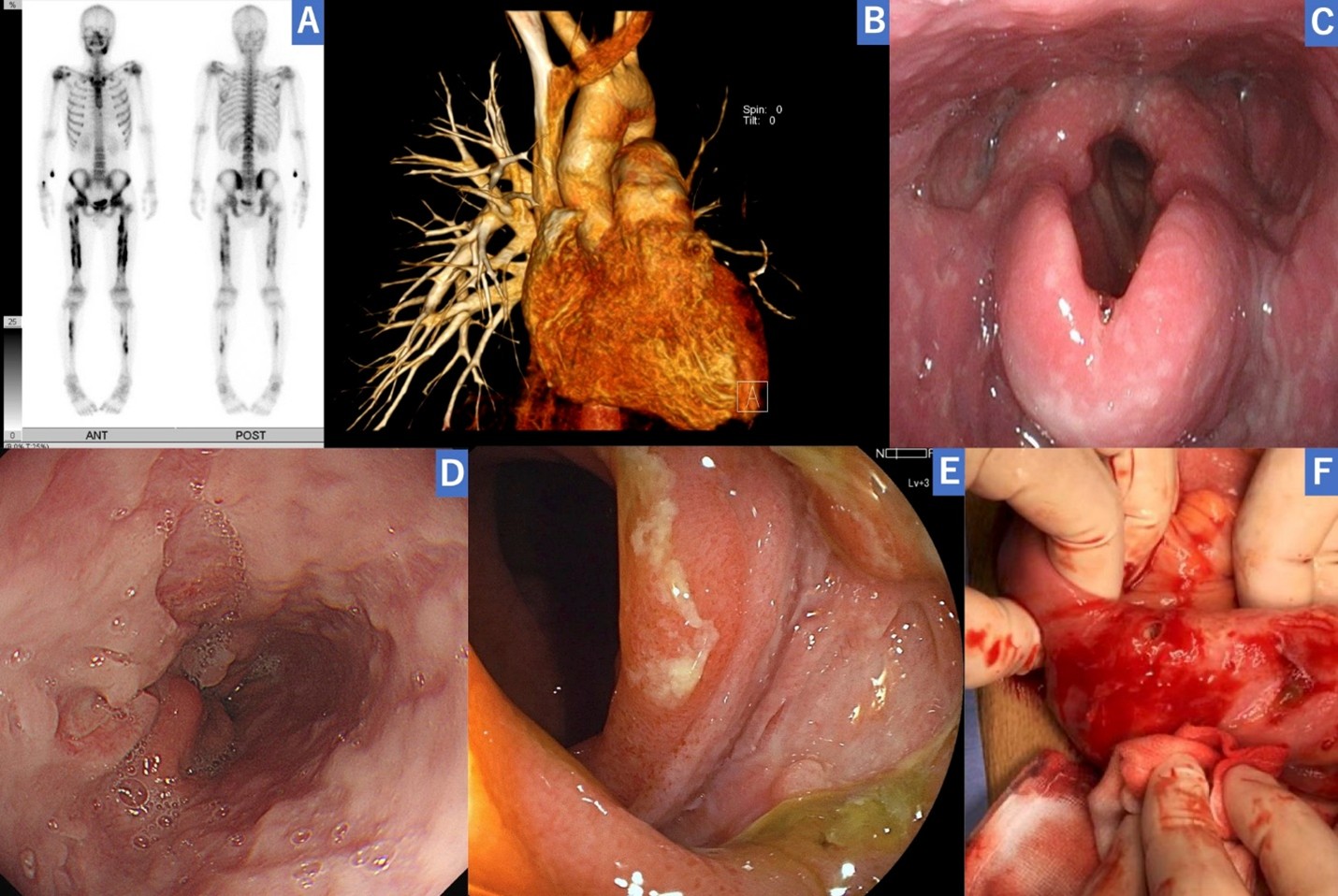 East Asia & Pacific Regional Winner