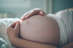 What is Pre-eclampsia?