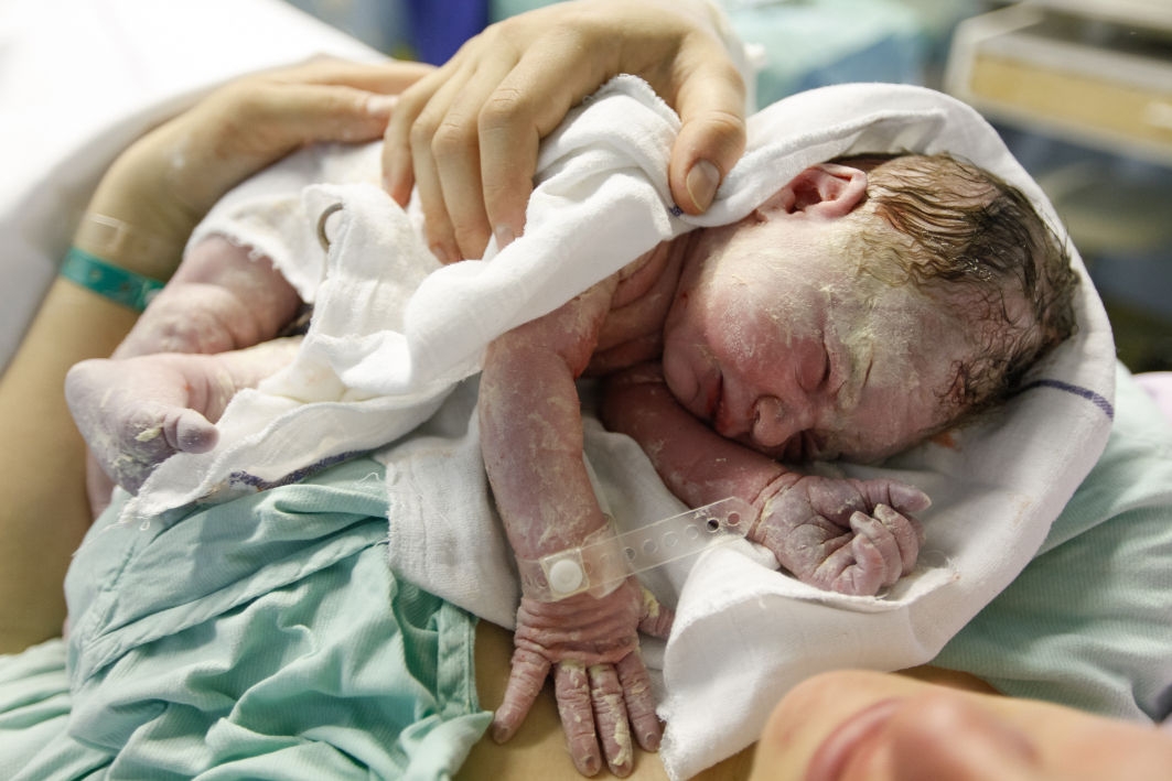 What is The Vernix Caseosa