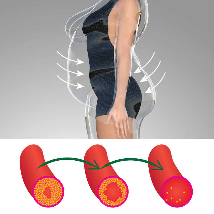 Reduce your cholesterol levels to help reduce body fat.jpg