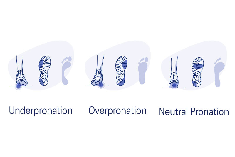 Shoe Pronation