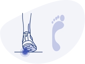 What is underpronation? Ground Contact: When landing, the outside of your heel lands first at an increased angle with little to no rolling (pronation). Push-Off: Pressure is focused on the outside of your foot and smaller toes. Foot Type: High arches. Potential Injuries: Shin splints, plantar fasciitis, ankle strain. Recommended Shoes: Shoes with extra cushioning.